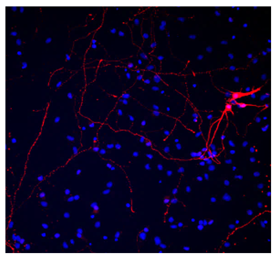 Neurones malades + CXS003