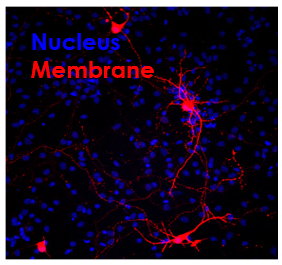 Neurones sains